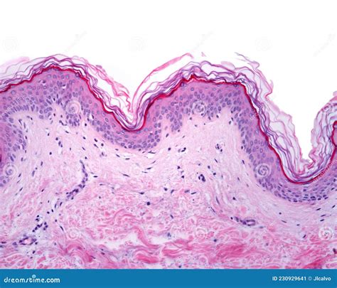 Skin. Dermis Reticular Royalty-Free Stock Photography | CartoonDealer.com #230644199