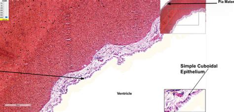 Image result for Ephilehal Tissue Sample
