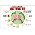 Anne Print Solutions® Sign Symptoms Of Active TB Poster For Hospital ...