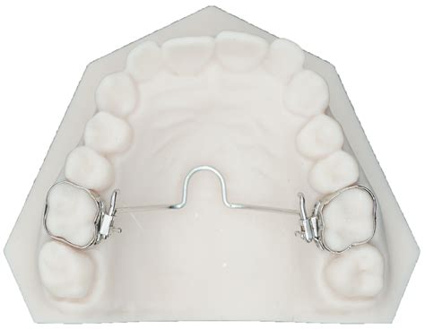 What Is A Palatal Arch at Deborah Mcgee blog