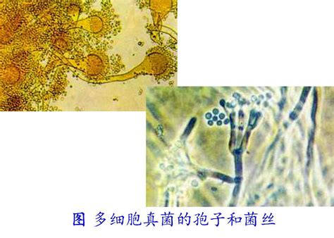 显微镜下的细胞真菌生物结构PNG图片素材下载_细胞PNG_熊猫办公