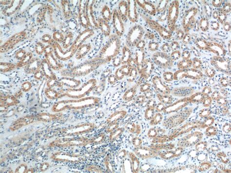 AKD1 antibody (23042-1-AP) | Proteintech