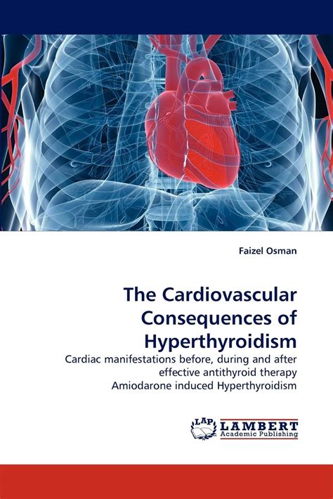 Buy The Cardiovascular Consequences of Hyperthyroidism: Cardiac ...