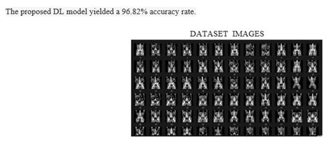 Prediction of Kidney Stones Using Machine Learning