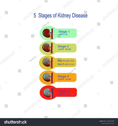 Chronic Kidney Disease Stage 5
