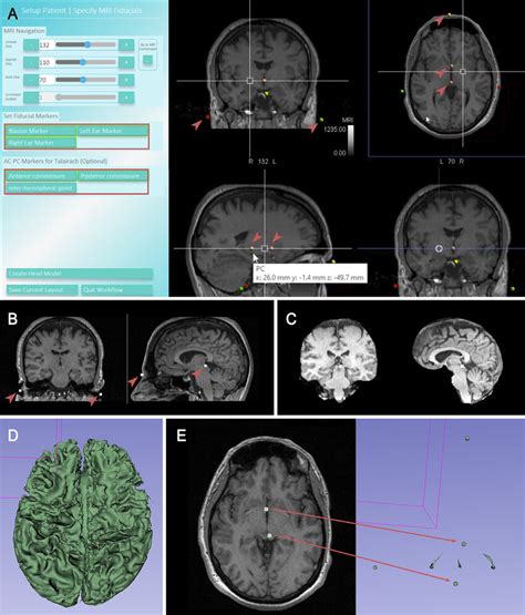 Image result for Python for MRI Data Processing