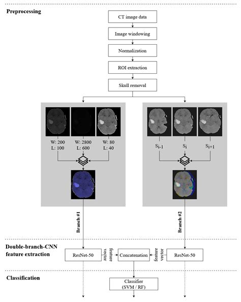 Intracranial Hemorrhage Detection in Head CT Using Double-Branch ...