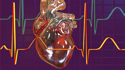 AFib Heart Condition 的图像结果