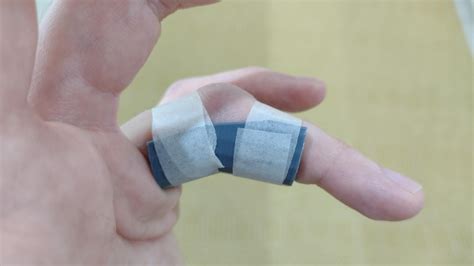 DIY splint for sprained finger. 10m design in tinkercad, 20m PLA+ print ...