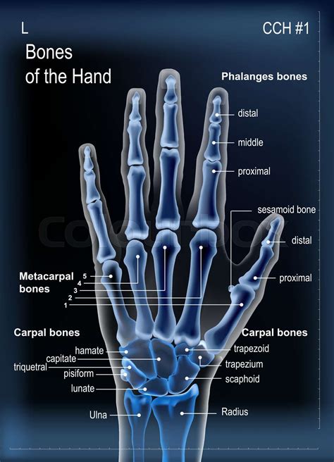 Frontal view x ray of bones the of hand with anotations. | Stock vector | Colourbox