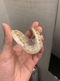 Image result for Bottom Teeth Calcium Buildup