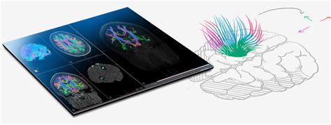 MRI Healthcare Systems & Innovative Healthcare Solutions | Kryptonite