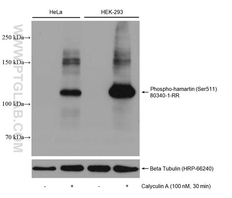 Phospho-Hamartin/TSC1 (Ser511) antibody (80340-1-RR) | Proteintech
