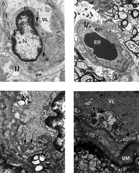 Oxidative Stress Induced Mitochondrial Failure and Vascular ...