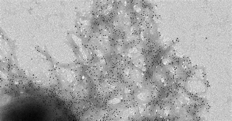 Image result for Bacteria Sensor Arduino