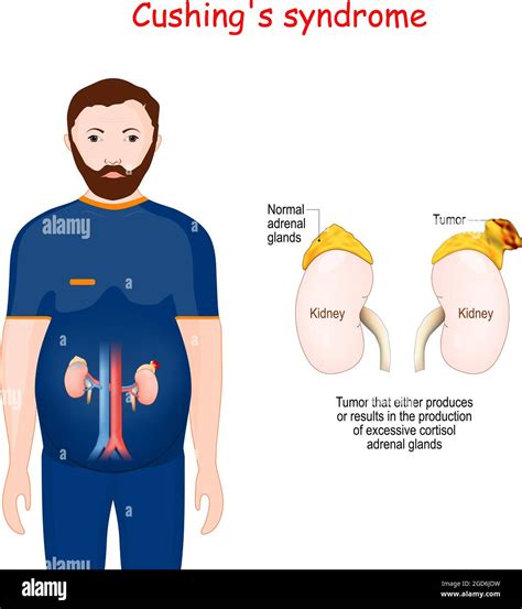 Suprarenal Cortex Highlighted