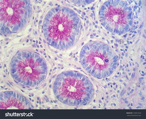 A Section Of Human Appendix Showing Crypts Of Lieberkuhn In Cross ...
