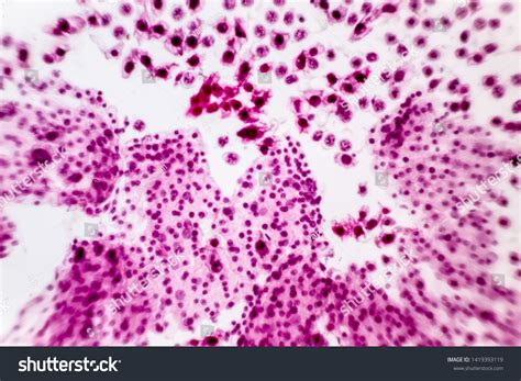 Meiosis Phases Microscope
