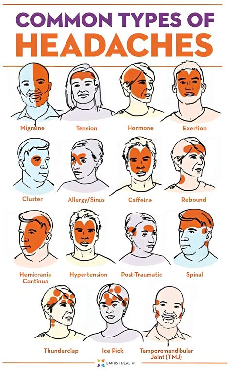 30+ Free Printable Headache Chart Templates [PDF]