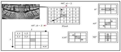 Decision-Support for Restorative Dentistry: Hybrid Optimization ...