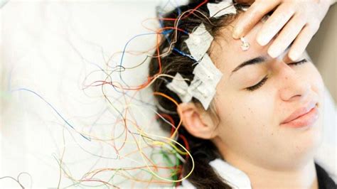 Image result for Absence Seizures