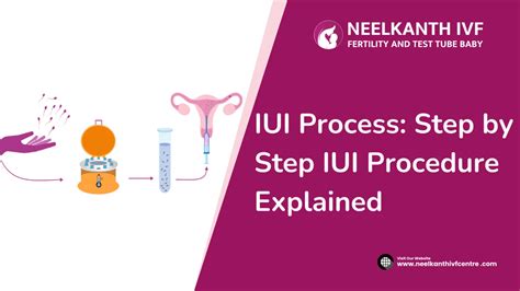 How Is IUI Procedure Done 的图像结果