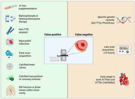 Non-Invasive Diagnostic Algorithm in Transthyretin Cardiac Amyloidosis ...