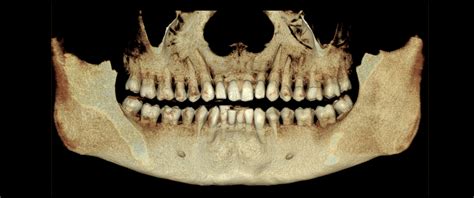 Dental Radiology Solution – Telereporting Services