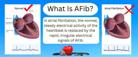 AFib Heart Condition 的图像结果