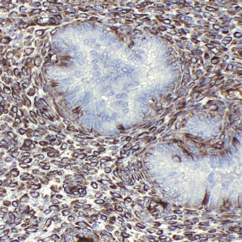 Vimentin-V9 | PathnSitu Biotechnologies