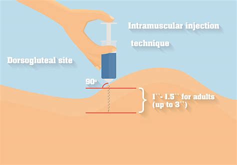 Injection 的图像结果