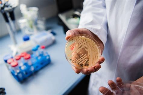 CDC曾发警告 纽约潜在致命真菌感染病例两位数上升 - 知乎