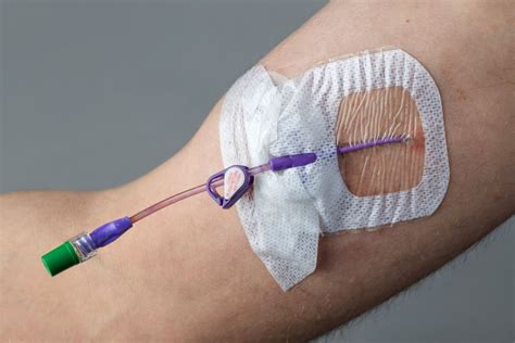Peripherally Inserted Central Catheter (PICC) training for nurses
