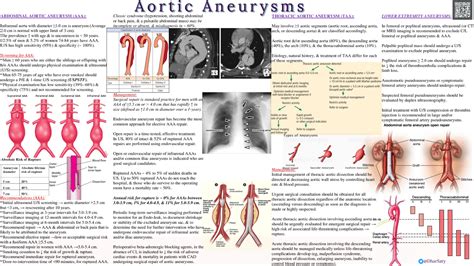 Aortic Aneurysms - Medical Infographics