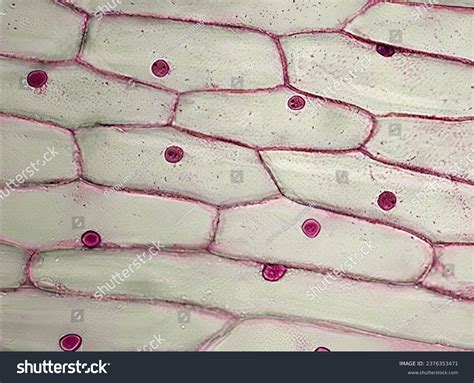 Onion Cell Under Microscope Nuclear Membrane
