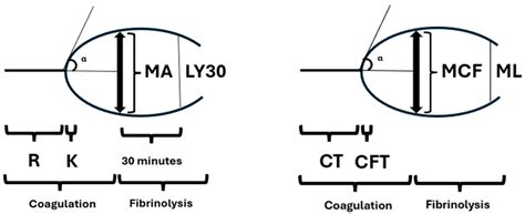 The Application of Viscoelastic Testing in Patient Blood Management