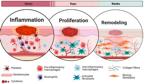 Cold Atmospheric Pressure Plasma: A Growing Paradigm in Diabetic Wound Healing—Mechanism and ...