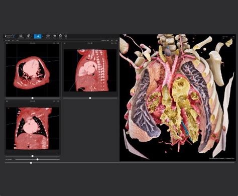 Spatial Reality Display, All you need is your eyes I ELF-SR1