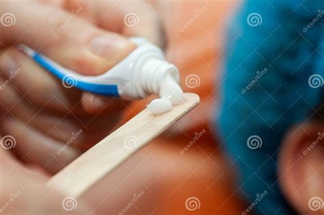 Surface Anesthesia 的图像结果