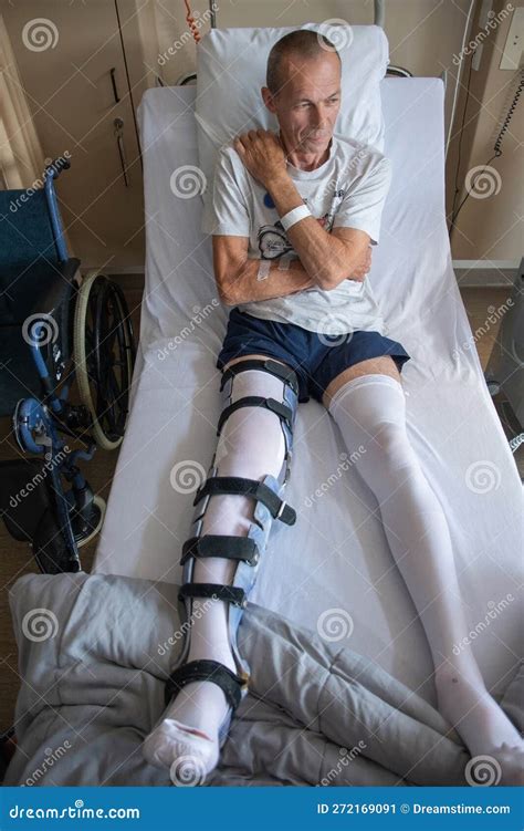 What Does A Broken Leg Look Like at Cristopher Robertson blog