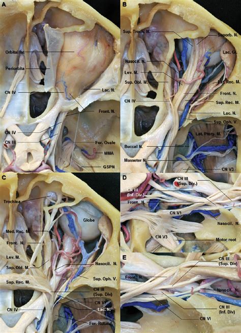 The Orbit and Superior Orbital Fissure | Neuroanatomy | The Neurosurgical Atlas