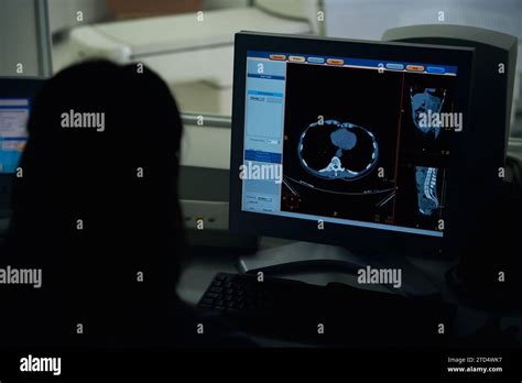 Image result for Computer Tomography Scanning