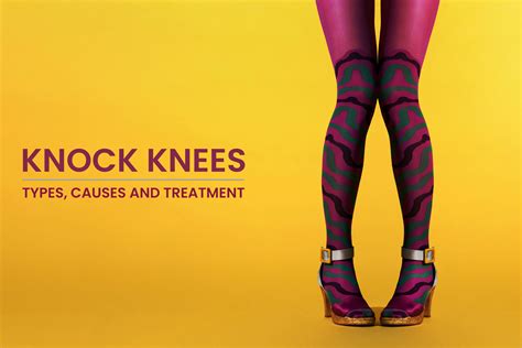 Knock Knees Medical Term