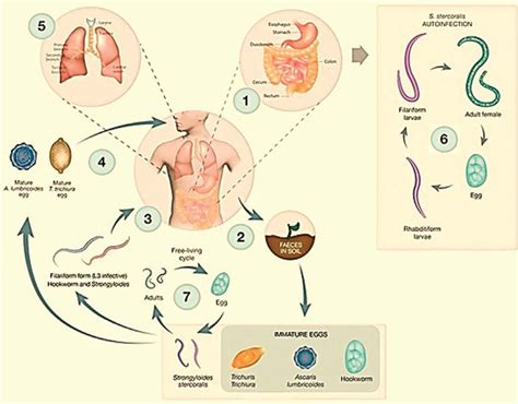 Human Soil-transmitted Helminths and Lung Infections: A Guide Review for Respiratory Therapists ...