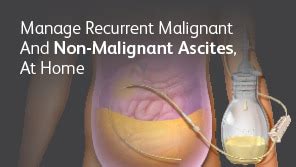 PeritX™ Catheter System - Home Ascites Management | BD