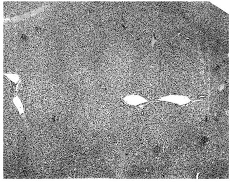 Viral Ecology and Natural Infection Dynamics of Kaeng Khoi Virus in ...