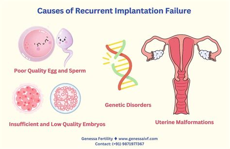 Recurrent Implantation Failure (RIF)