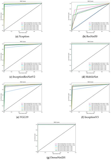 Privacy-Preserving Transfer Learning Framework for Kidney Disease Detection