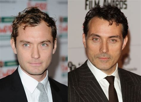 Rufus Sewell Face Surgery