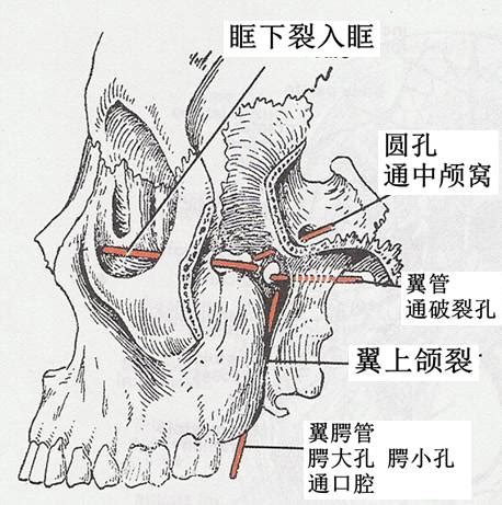 影像解剖丨翼腭窝的CT影像解剖__中国医疗